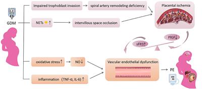 Gestational Diabetes Mellitus and Preeclampsia: Correlation and Influencing Factors